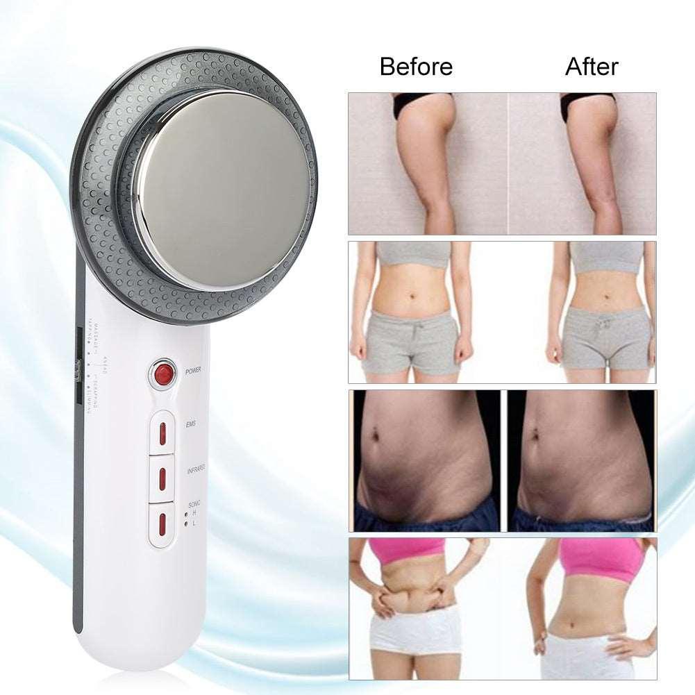 Beauty Care Handheld Ultrasound Body Fat Remove Massager - Arovion